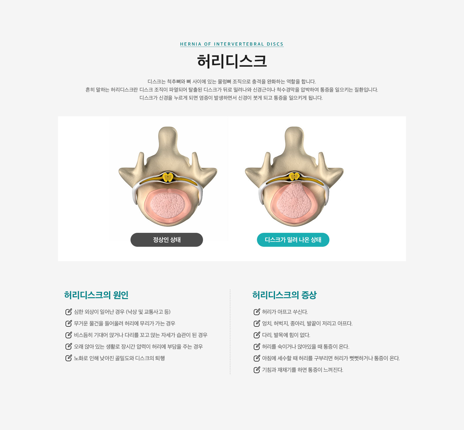 허리디스크