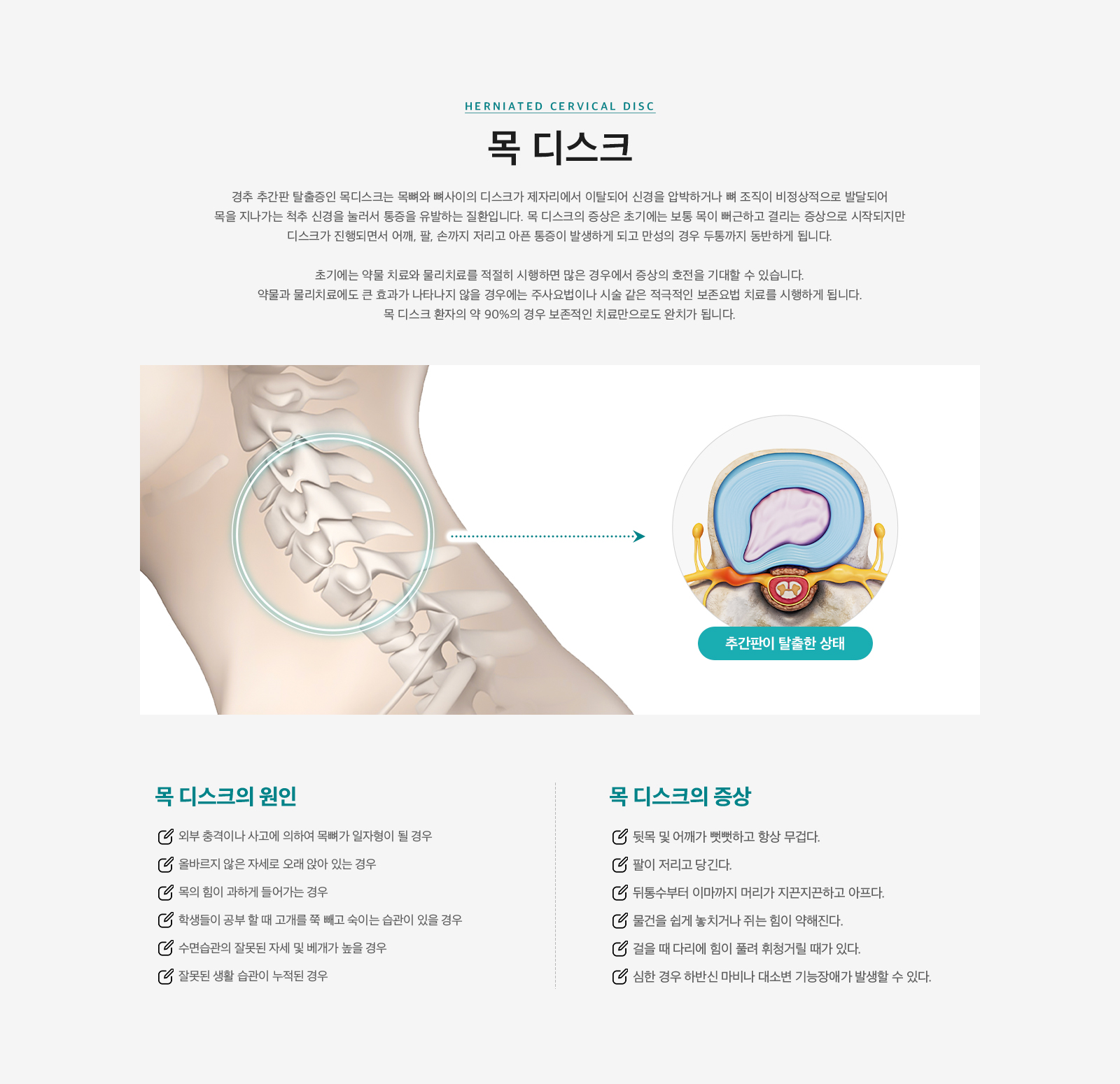 목 디스크