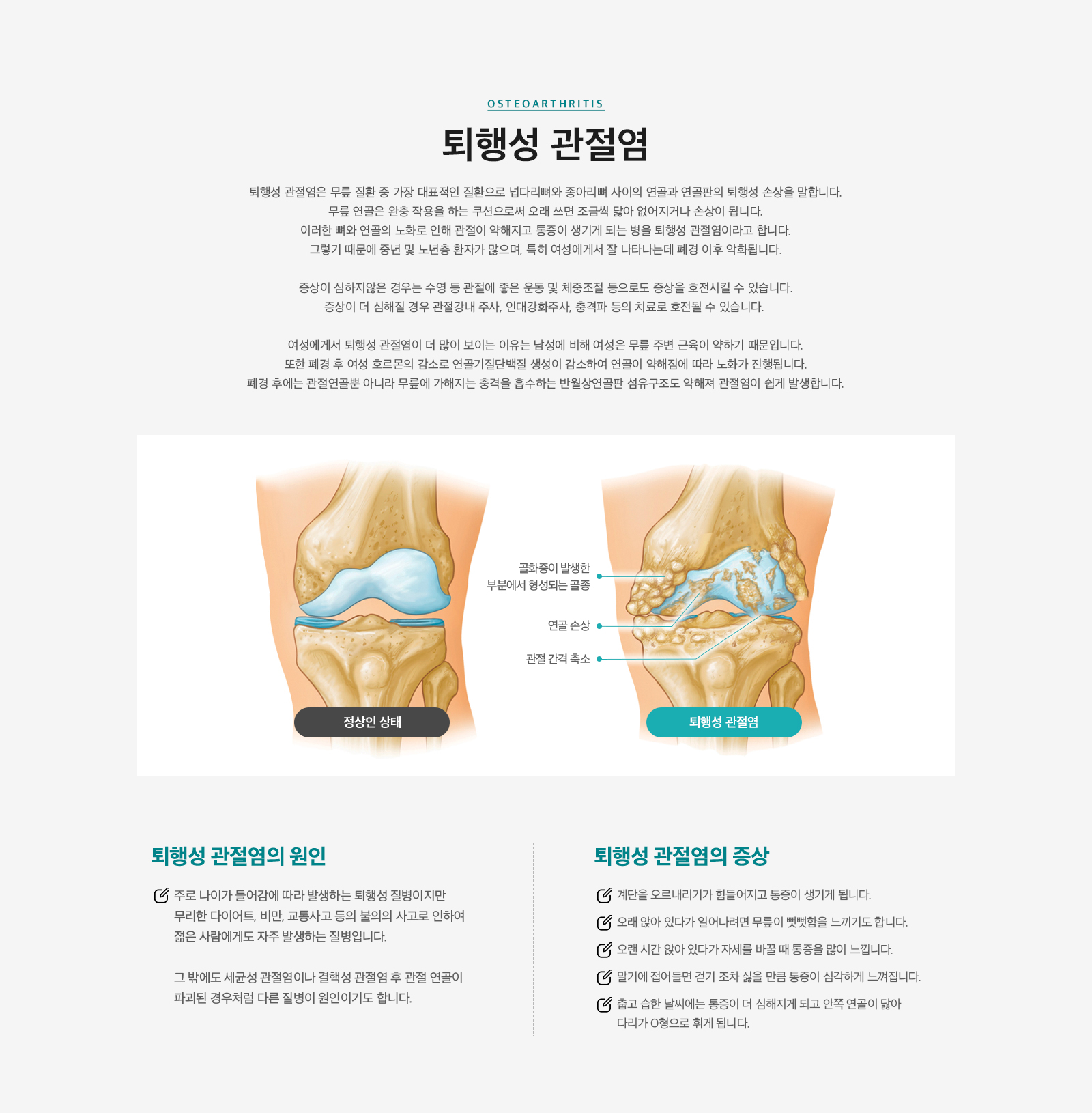 퇴행성 관절염