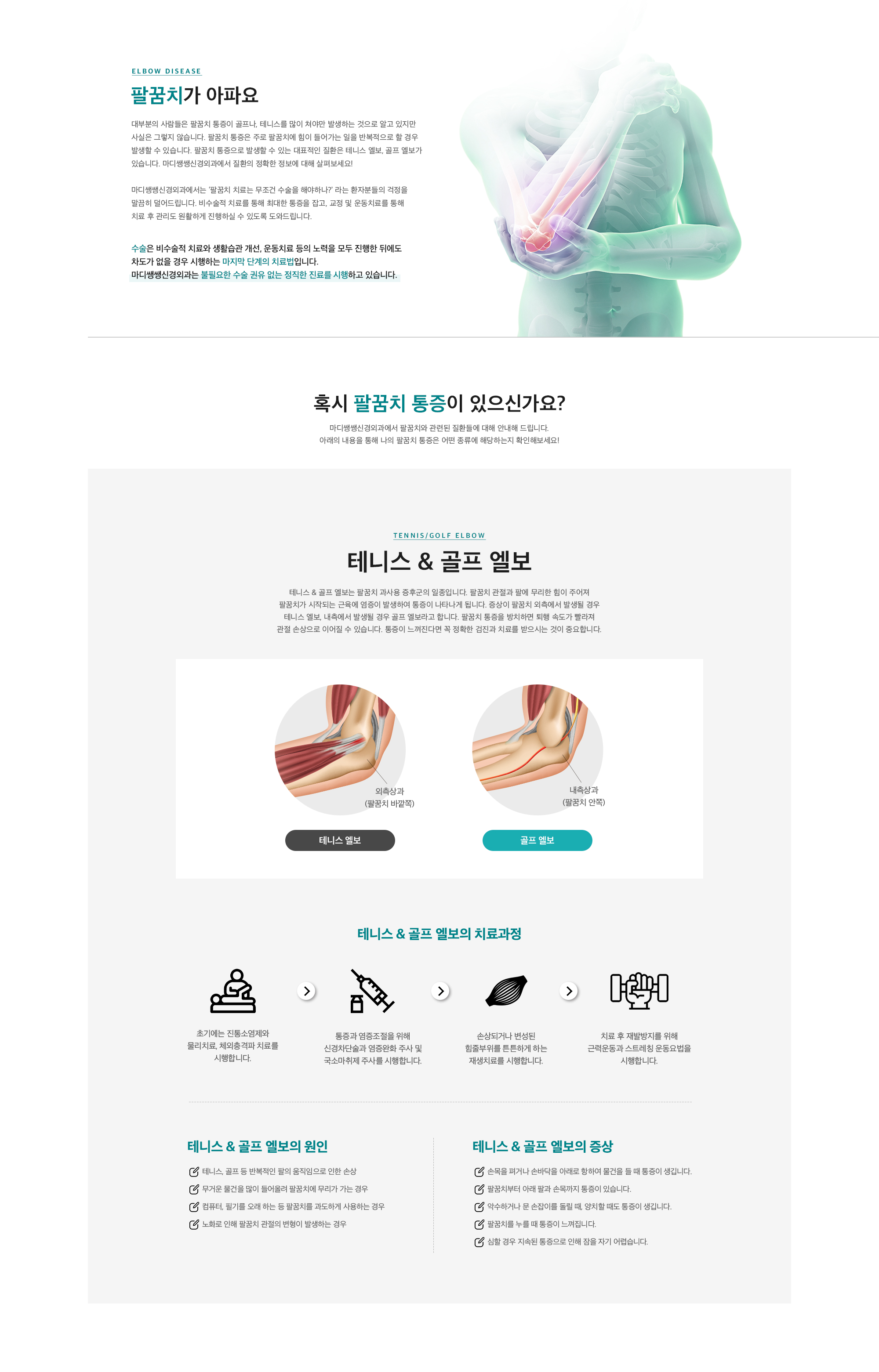 팔꿈치가 아파요