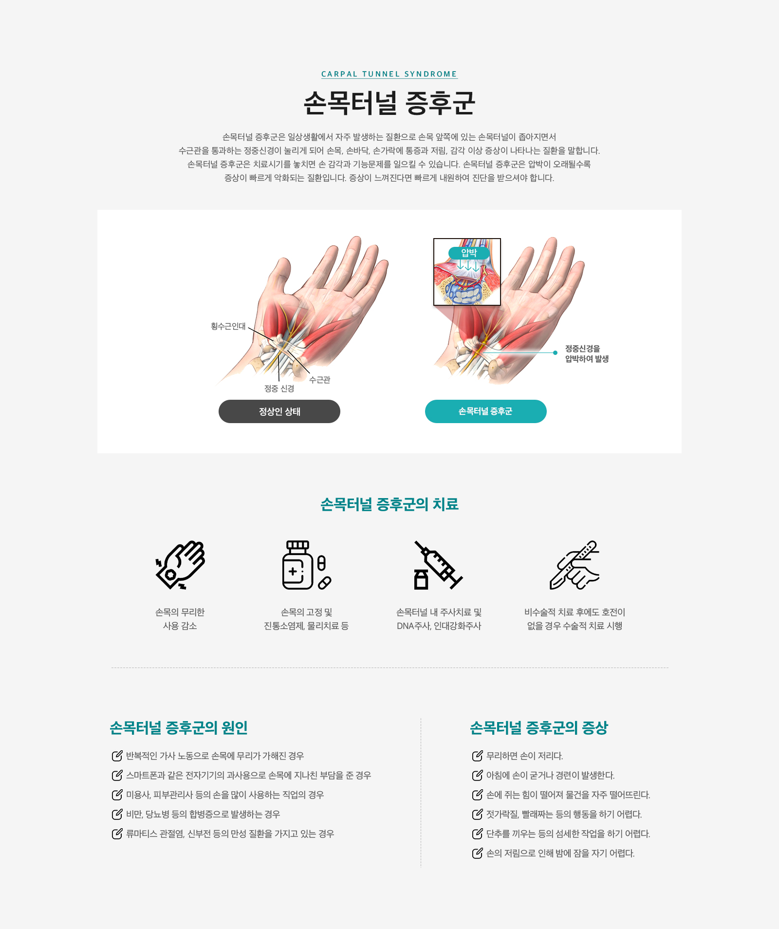 손목터널 증후군